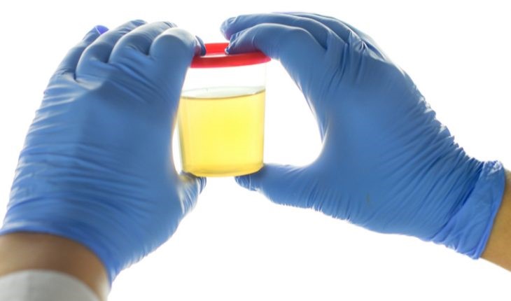 Synthetic Urine For Physical Grand Harbor Ninety Six SC